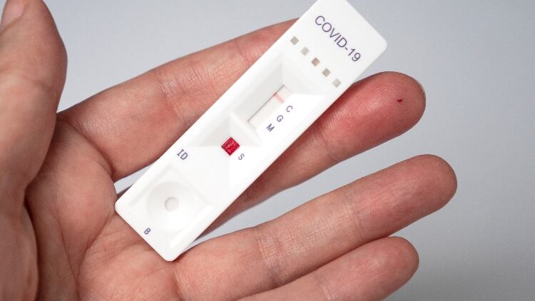Pubs urged to register for free workplace testing