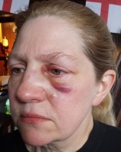 Teena Birch was assaulted in her pub