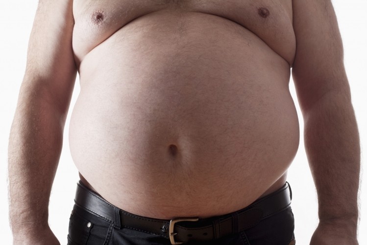 Figures suggest 67% of men and 57% of women in the UK are overweight or obese